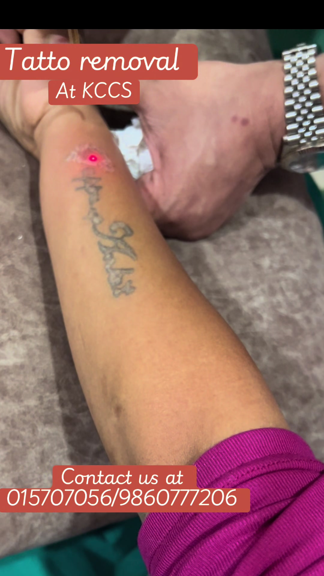 @Dr. Mainali, plastic surgeon