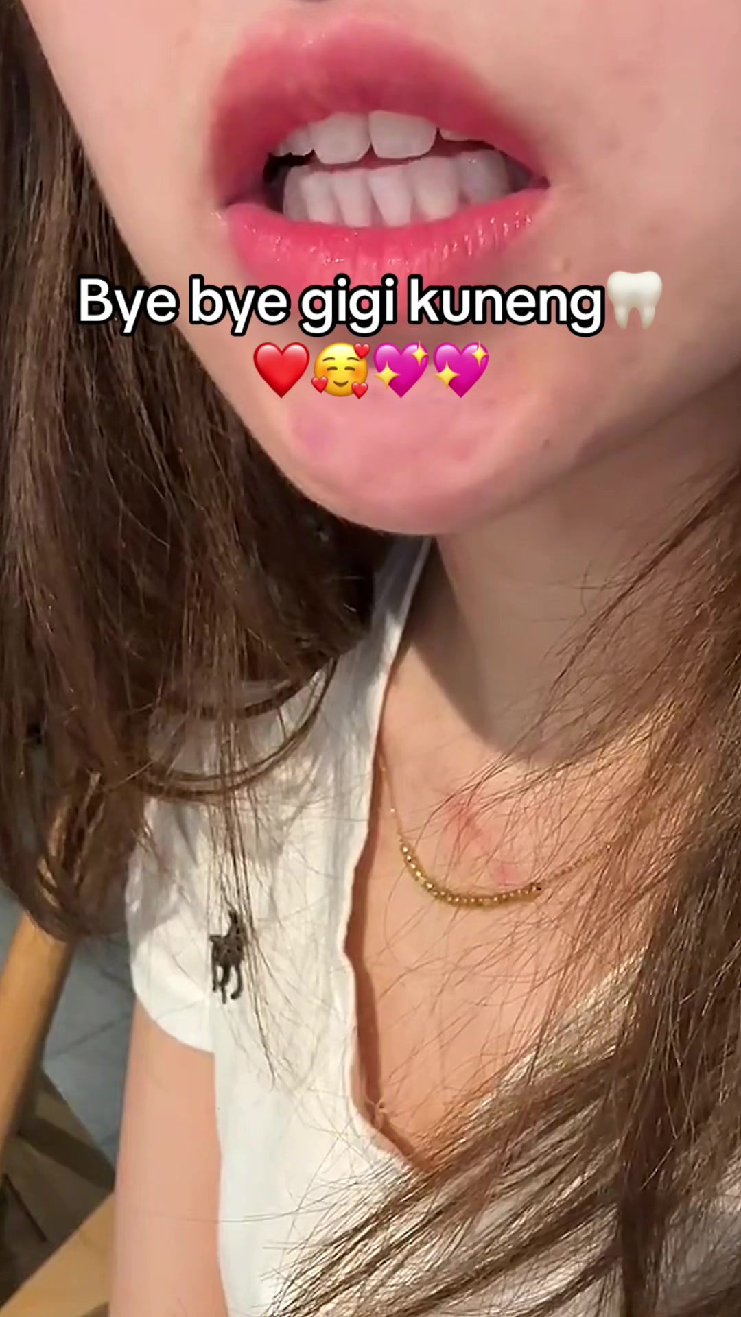 @Gigi Putih Berkilau🦷✨