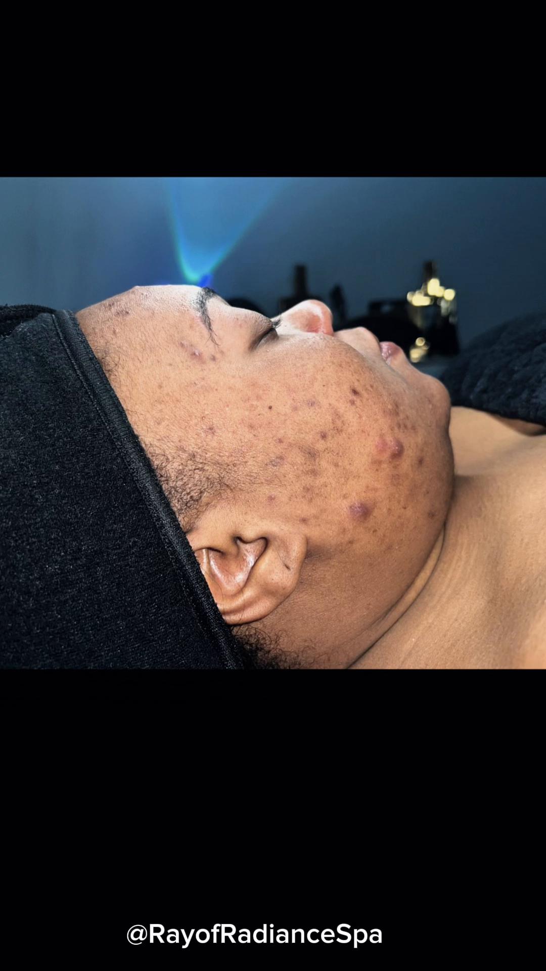 @Rosey-FL Esthetician/laserTech