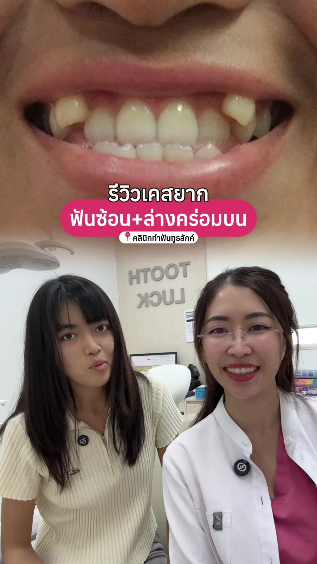 @ณัฐคุณ (Nuttakul Dent) 🦷
