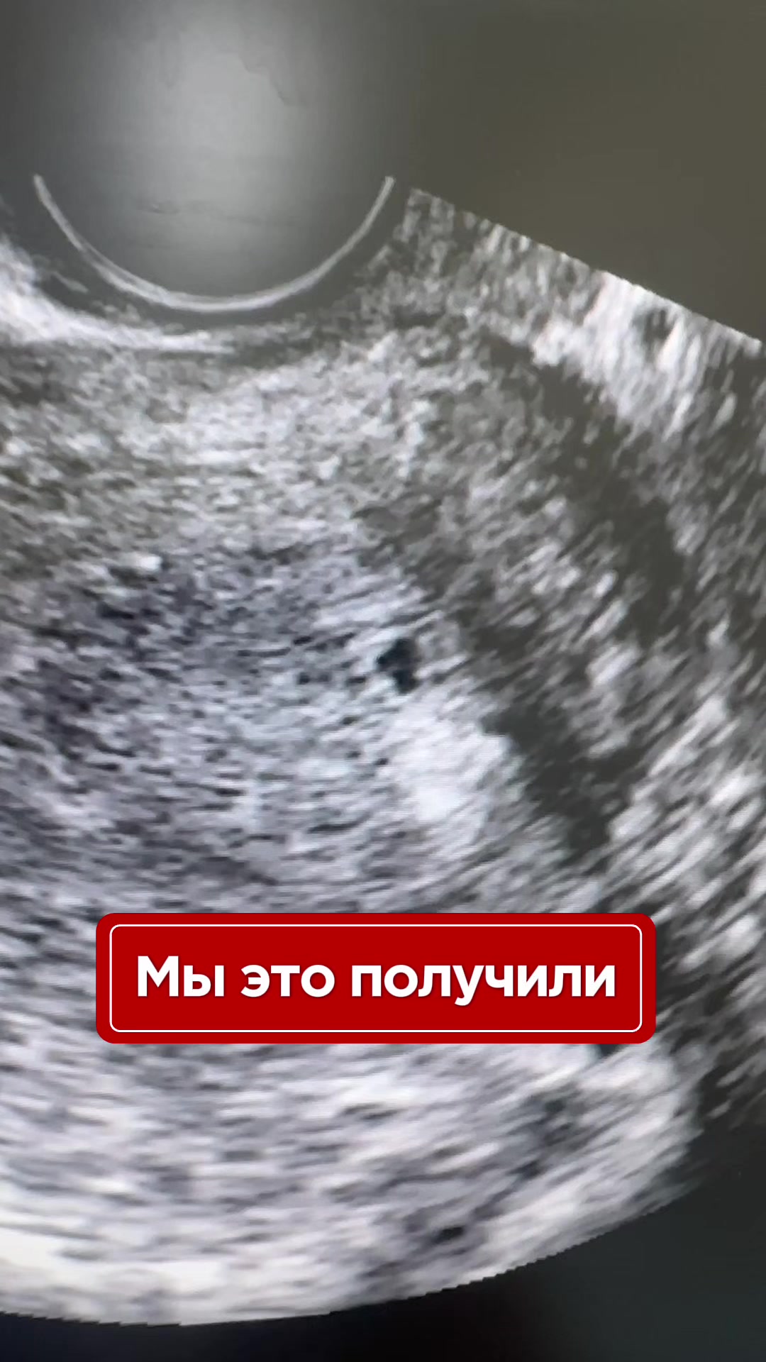 @Гинеколог Москва