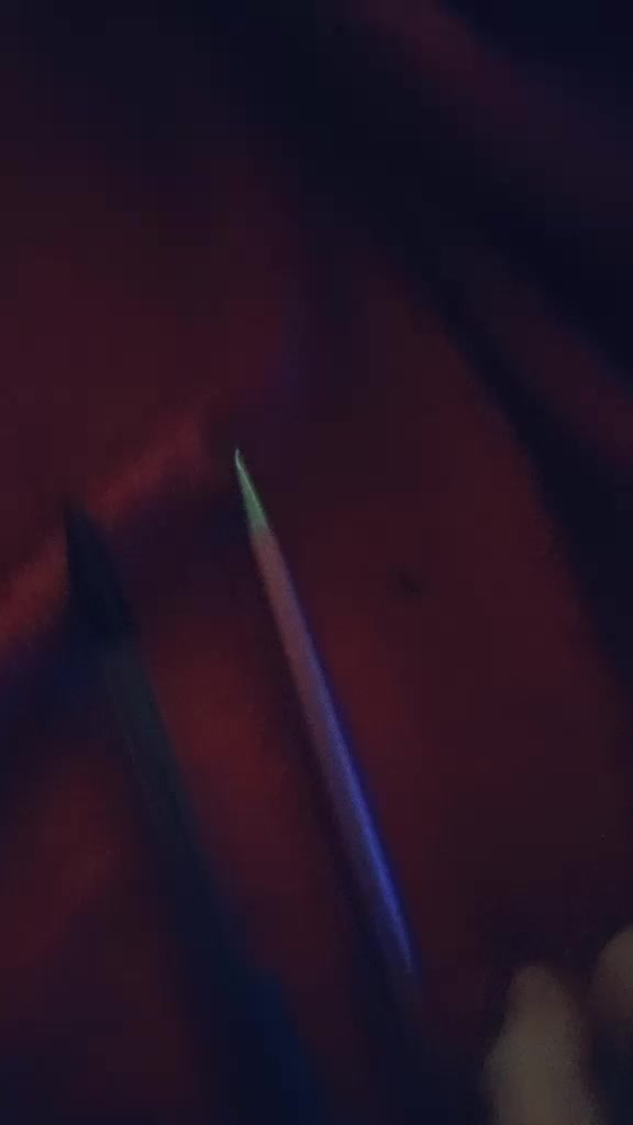 @{BUG}