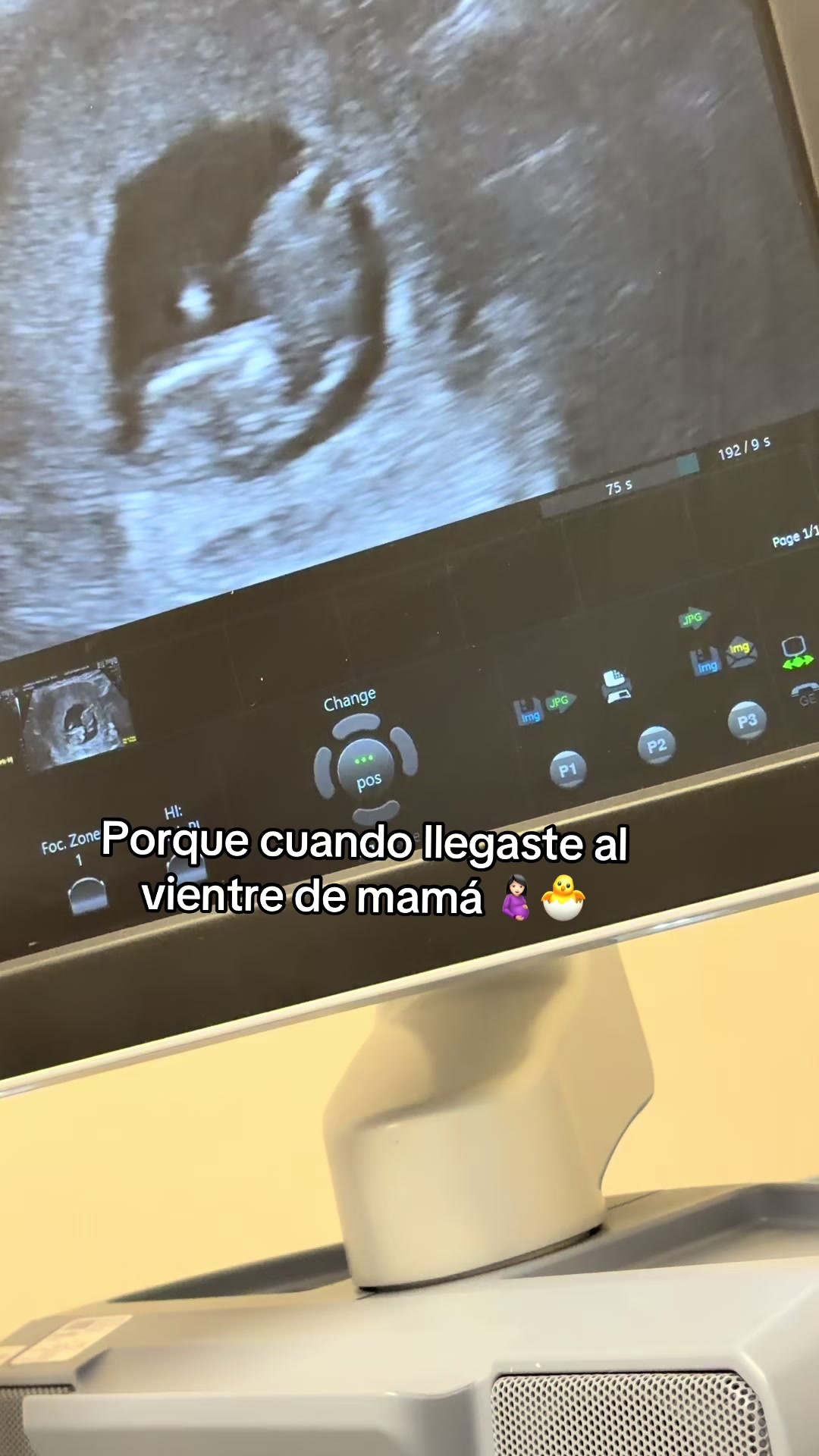 @Magda & Gladys🩷🥺