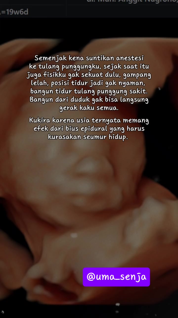 @nura_ini83
