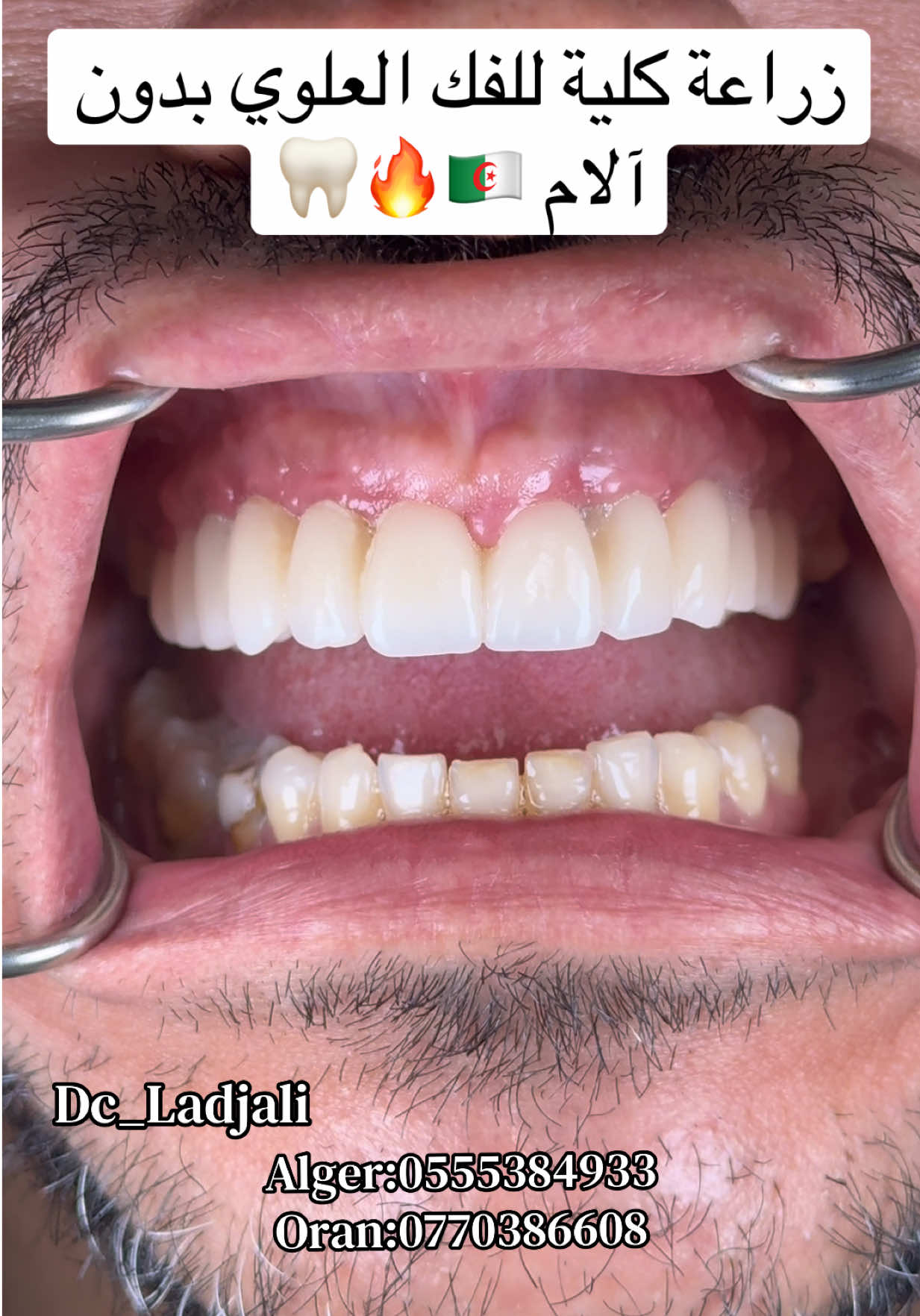 @Dr.ladjali