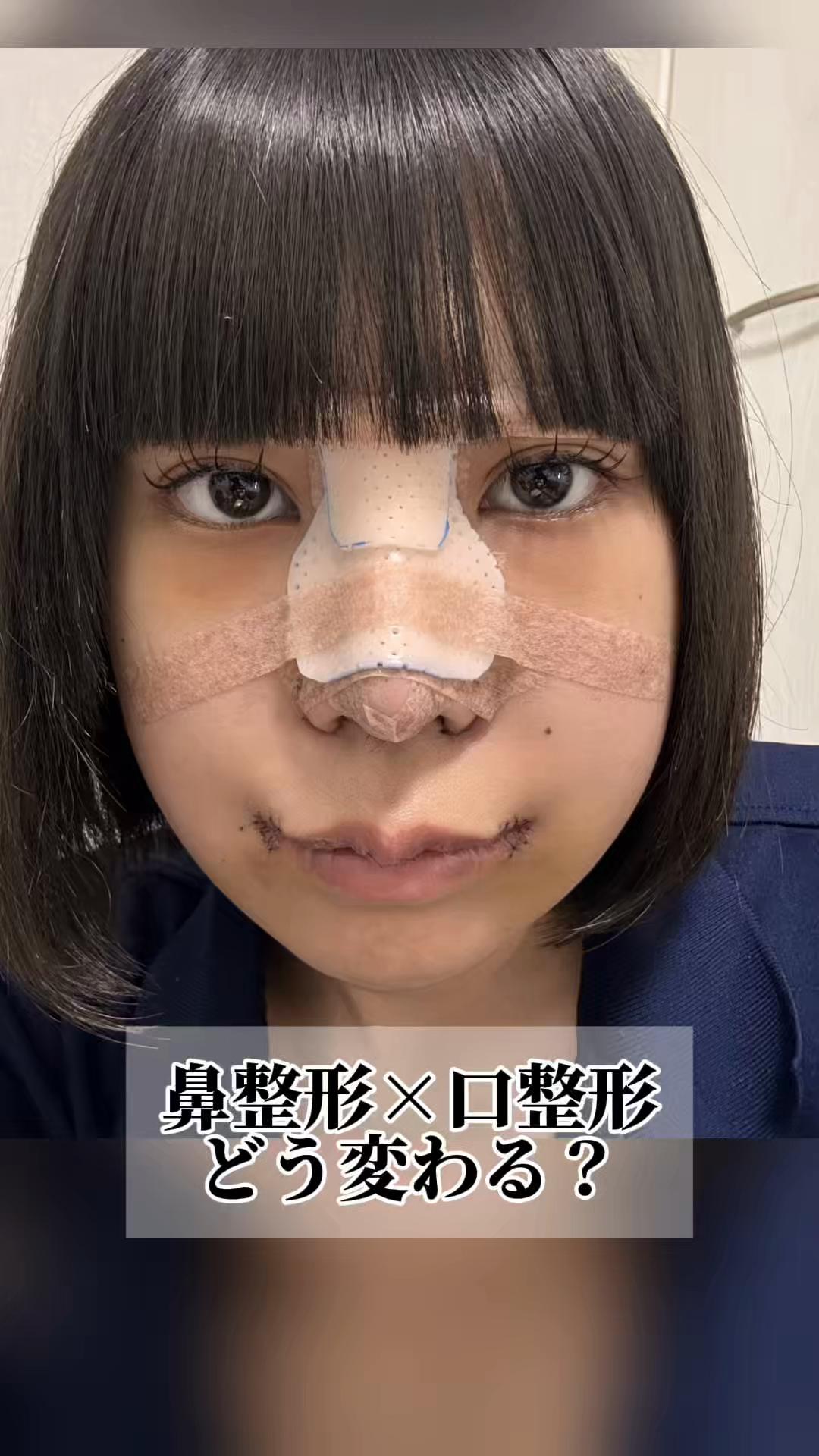 @鼻整形R Beauty CLINIC 副院長👨&zwj;⚕️吉田慧