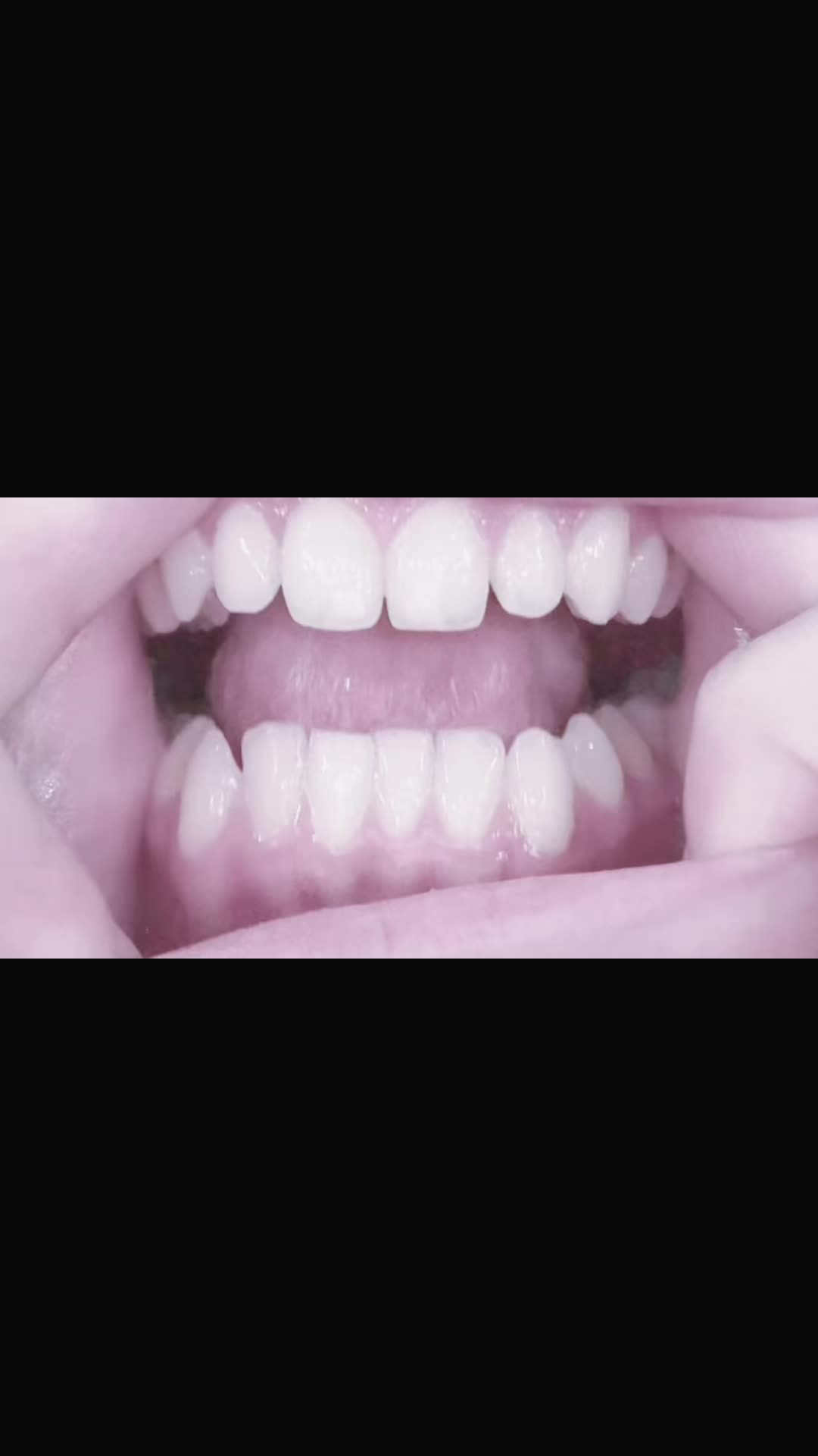 @•๐•