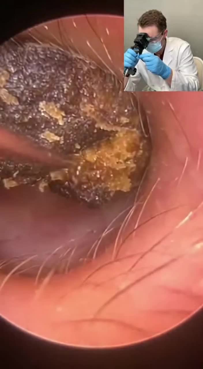 @Ear Cleaning