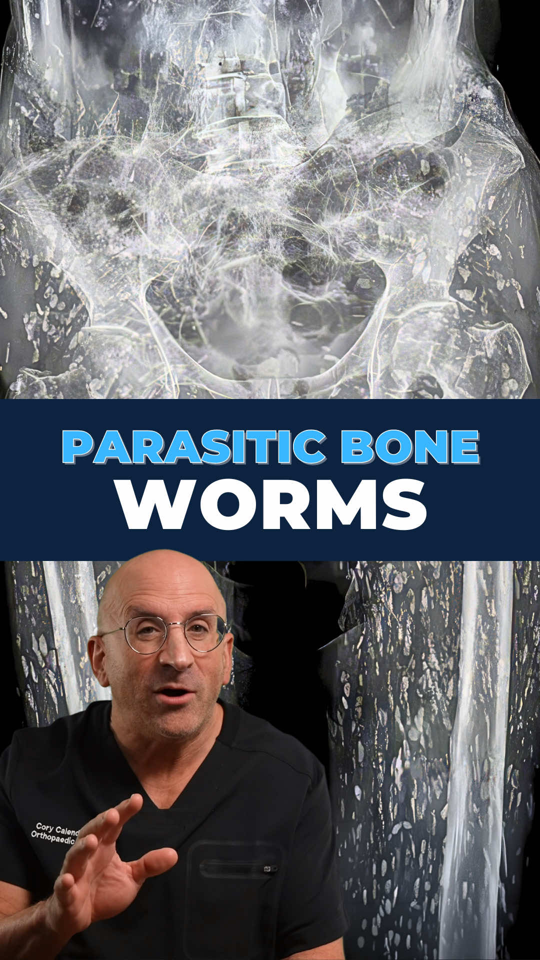 @Bone Doctor - Joint Pain MD