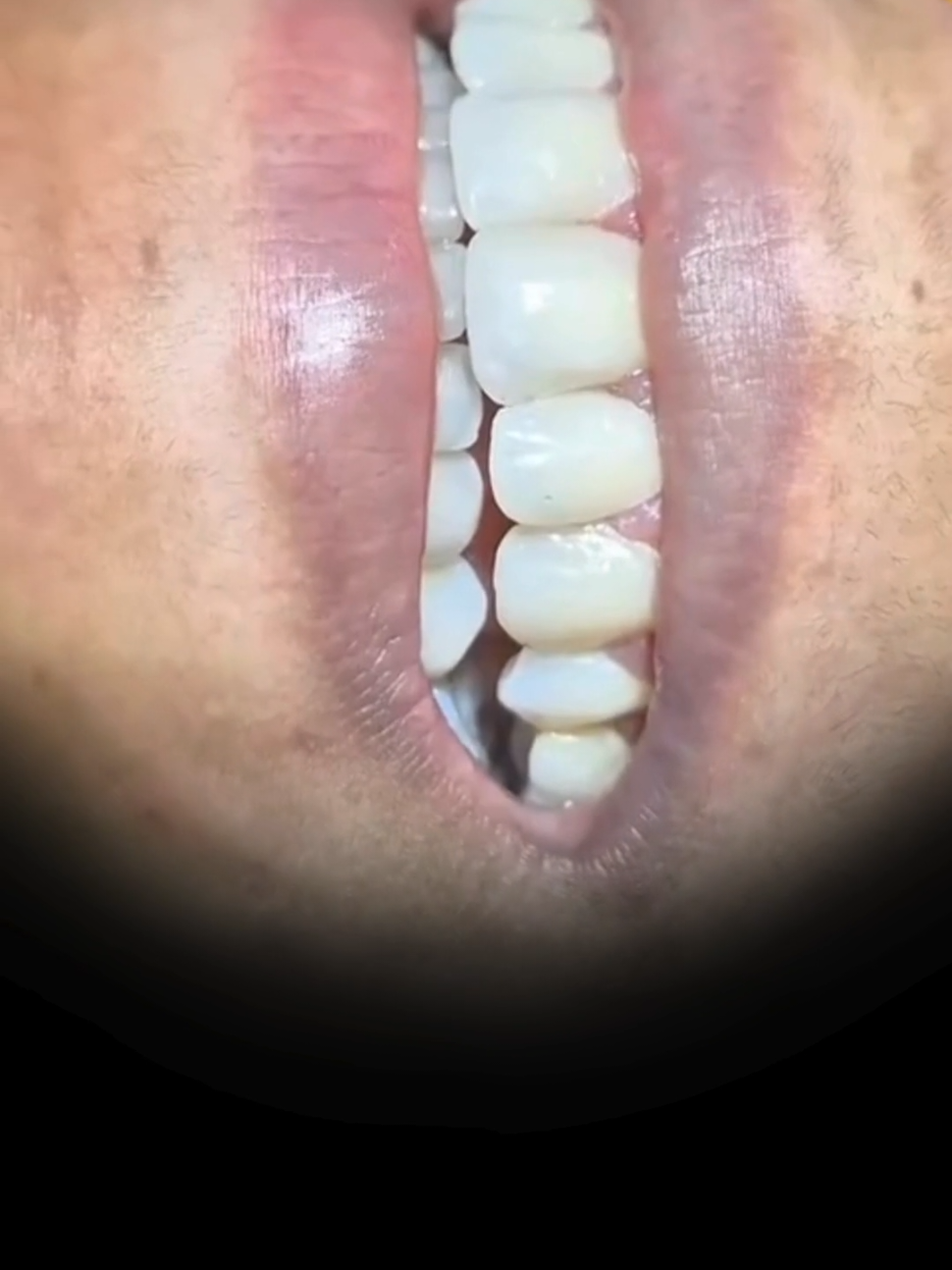 @Easy Dental