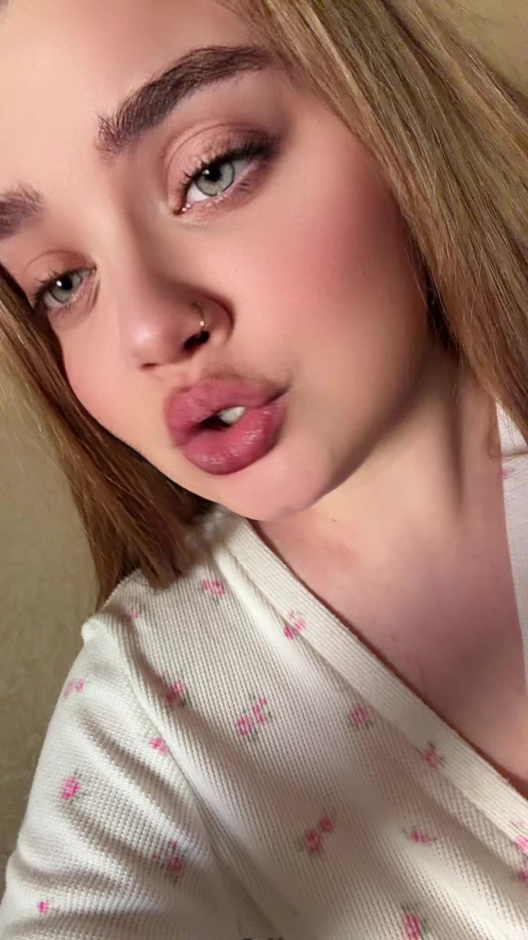 @anafox