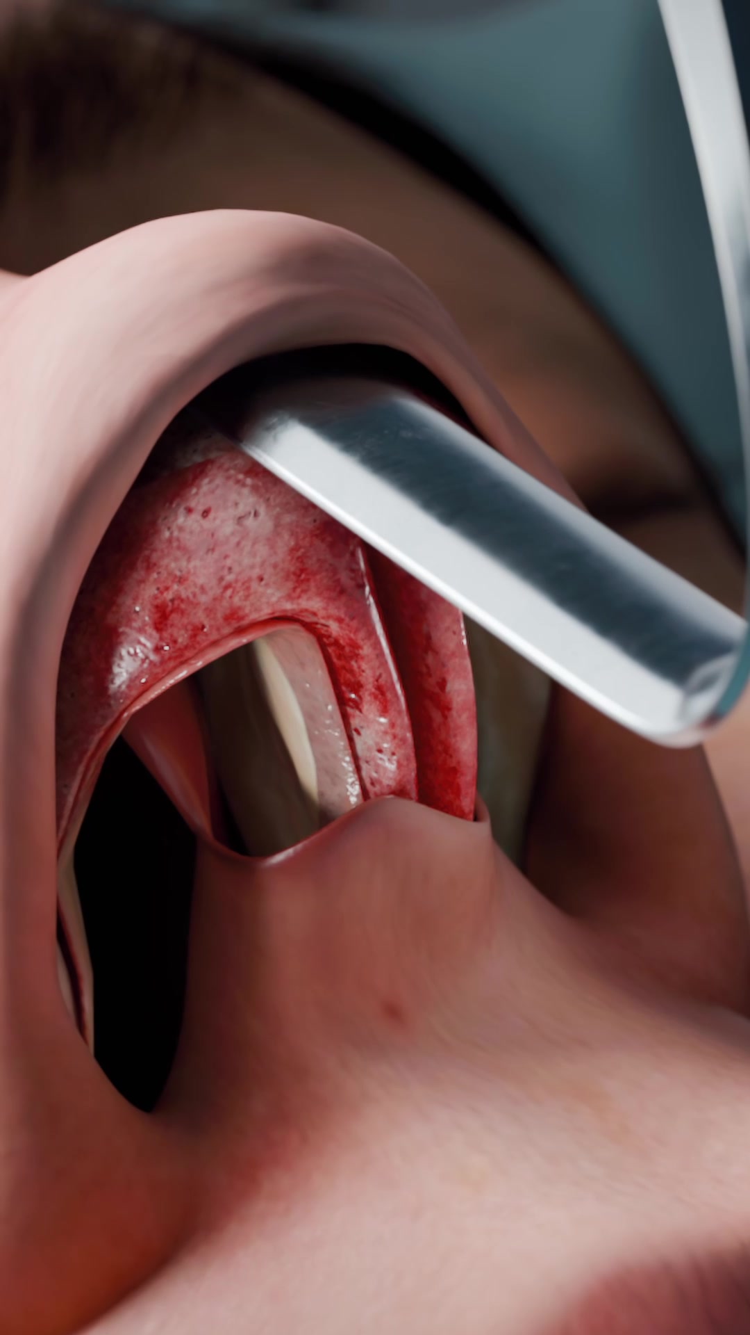 @VOKA 3D Anatomy & Pathology