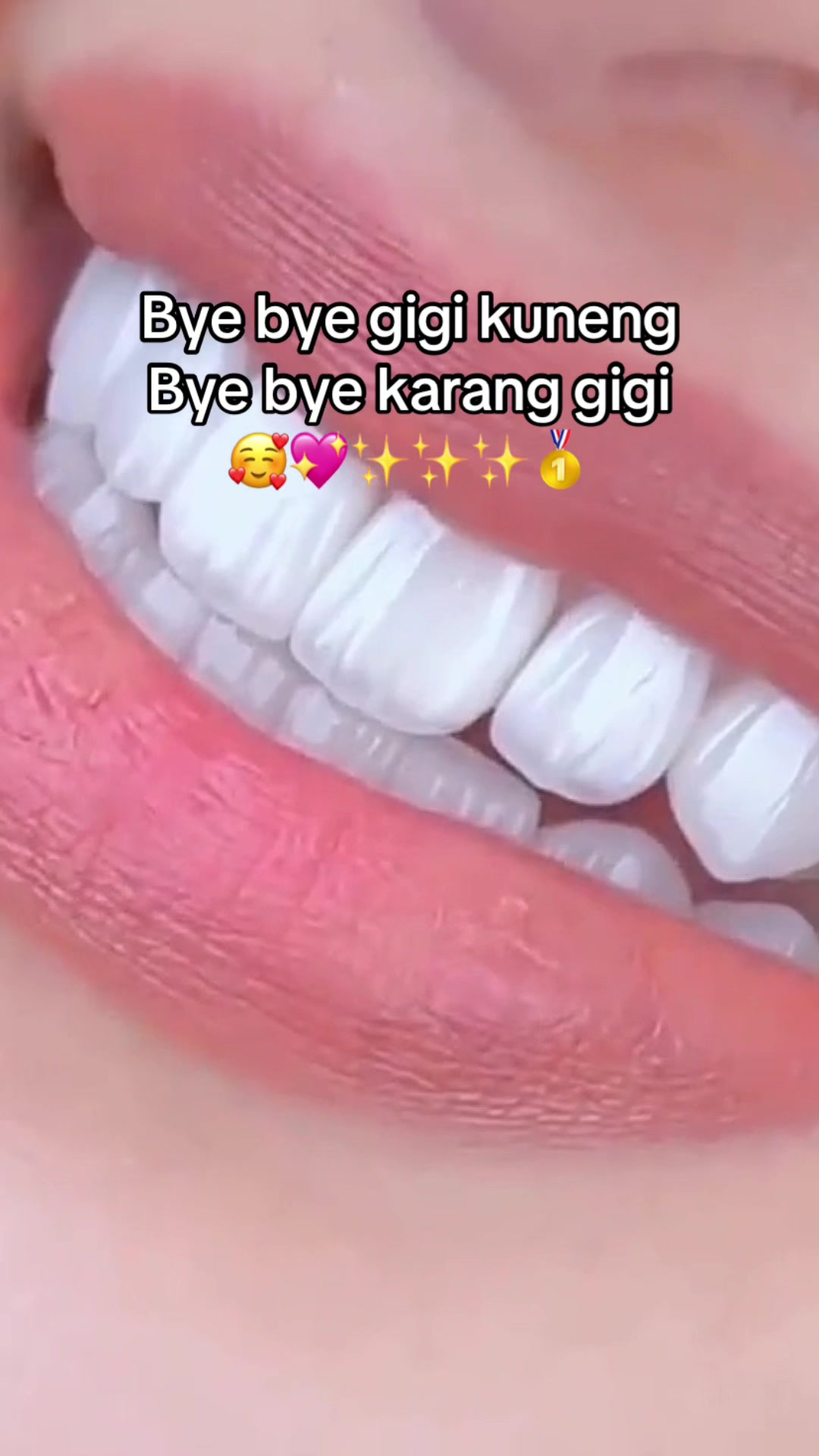 @Gigi Putih Berkilau🦷✨