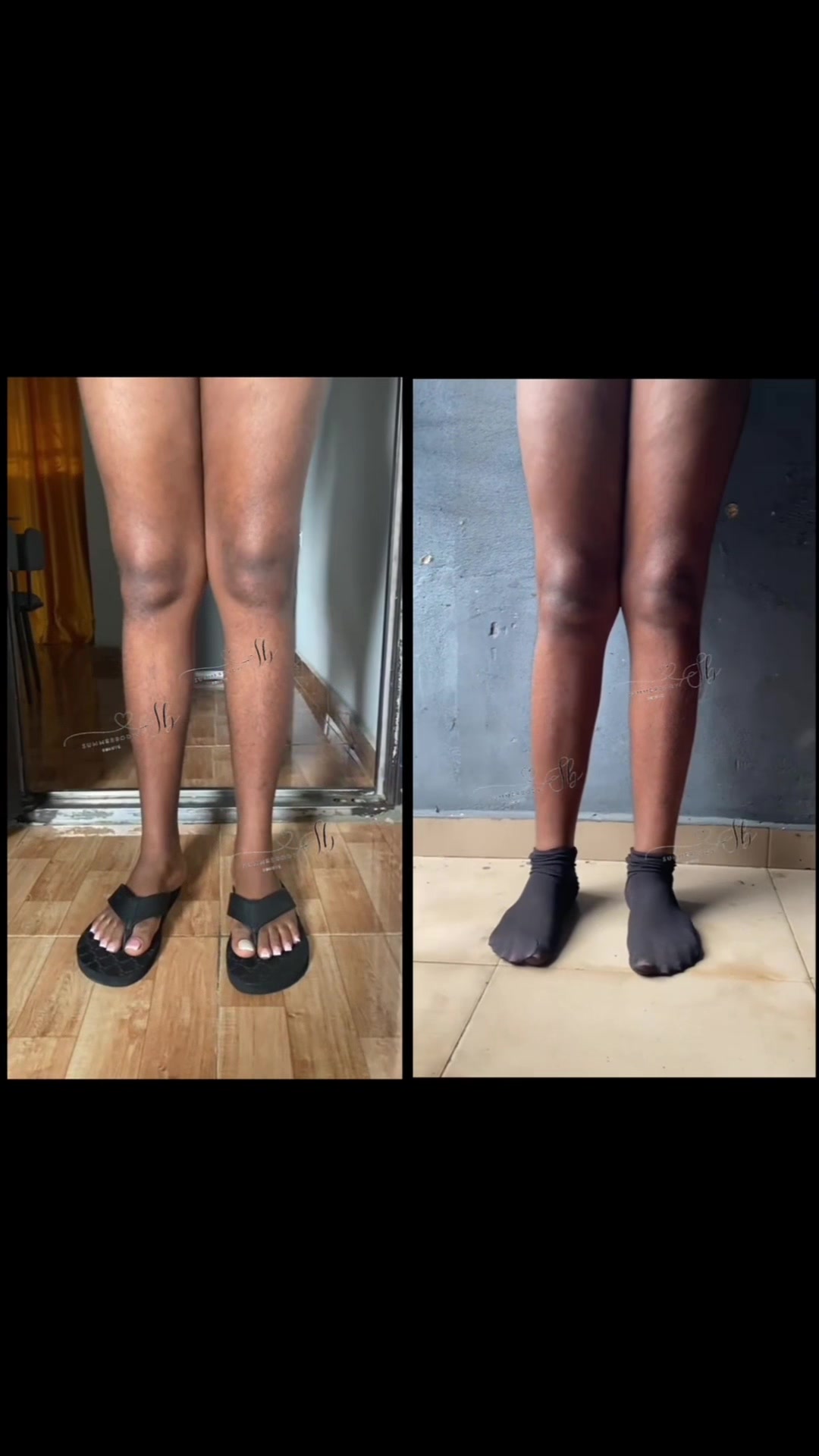 @summerbody
