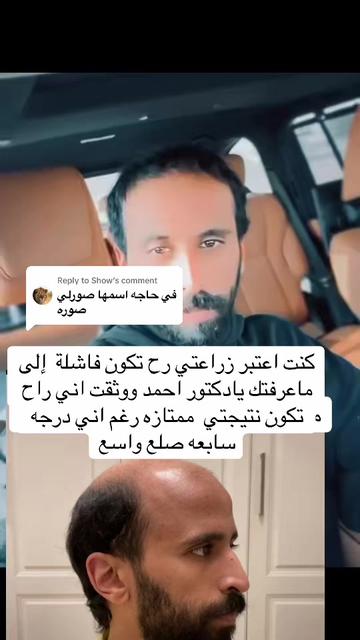 @Dr. Ahmed Alkhateeb