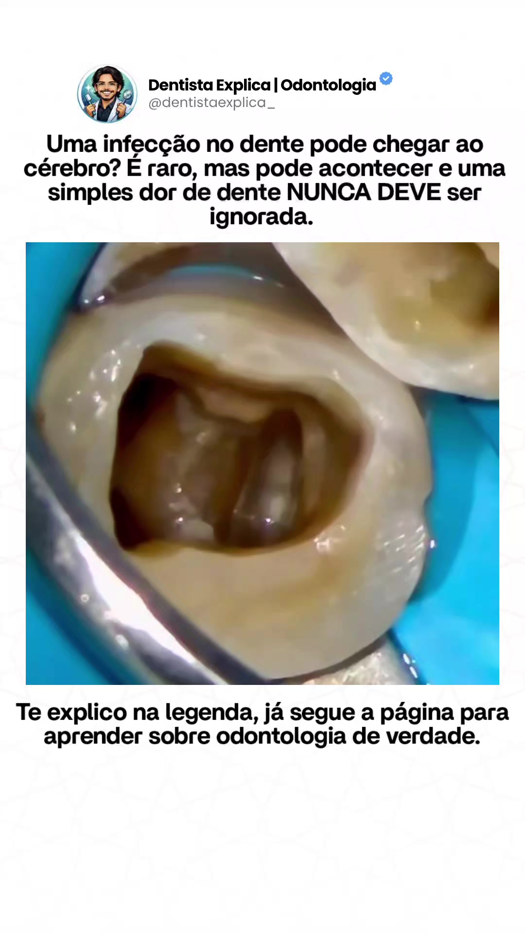 @Dentista Explica | Odontologia