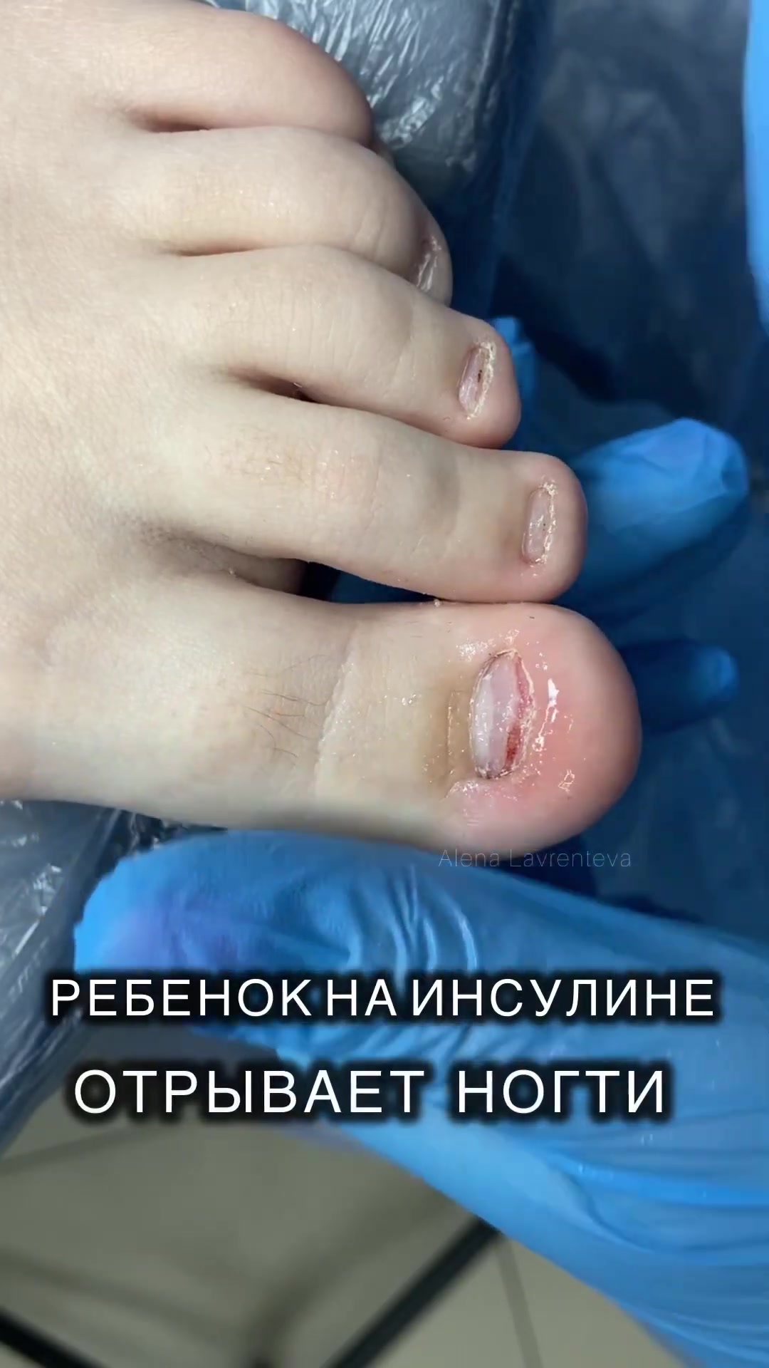 @Алёна Лаврентьева