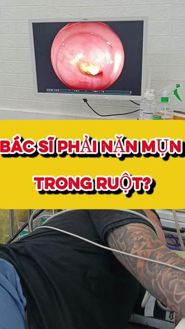 @Nội Soi Ti&ecirc;u H&oacute;a Cần Thơ