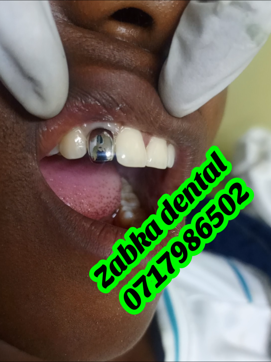 @Zabka Dental