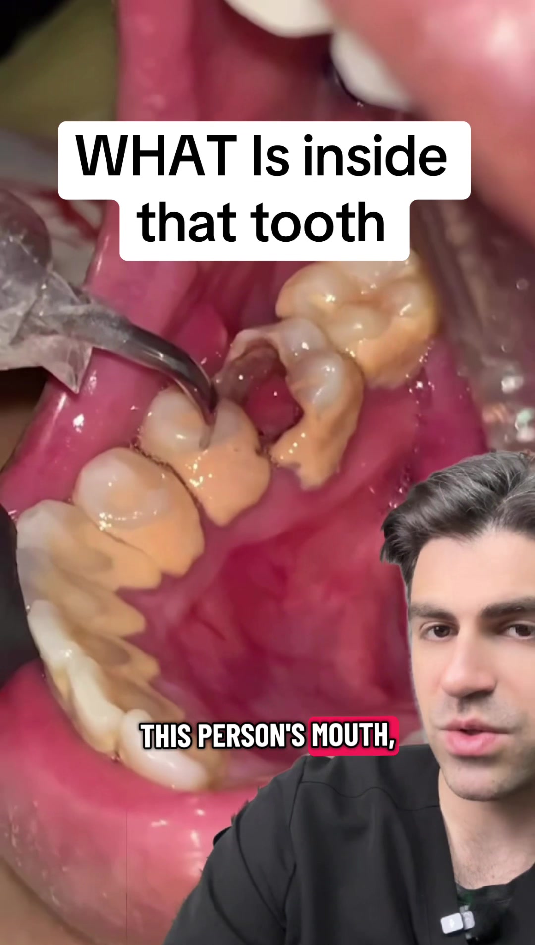 @Dr. Kadish