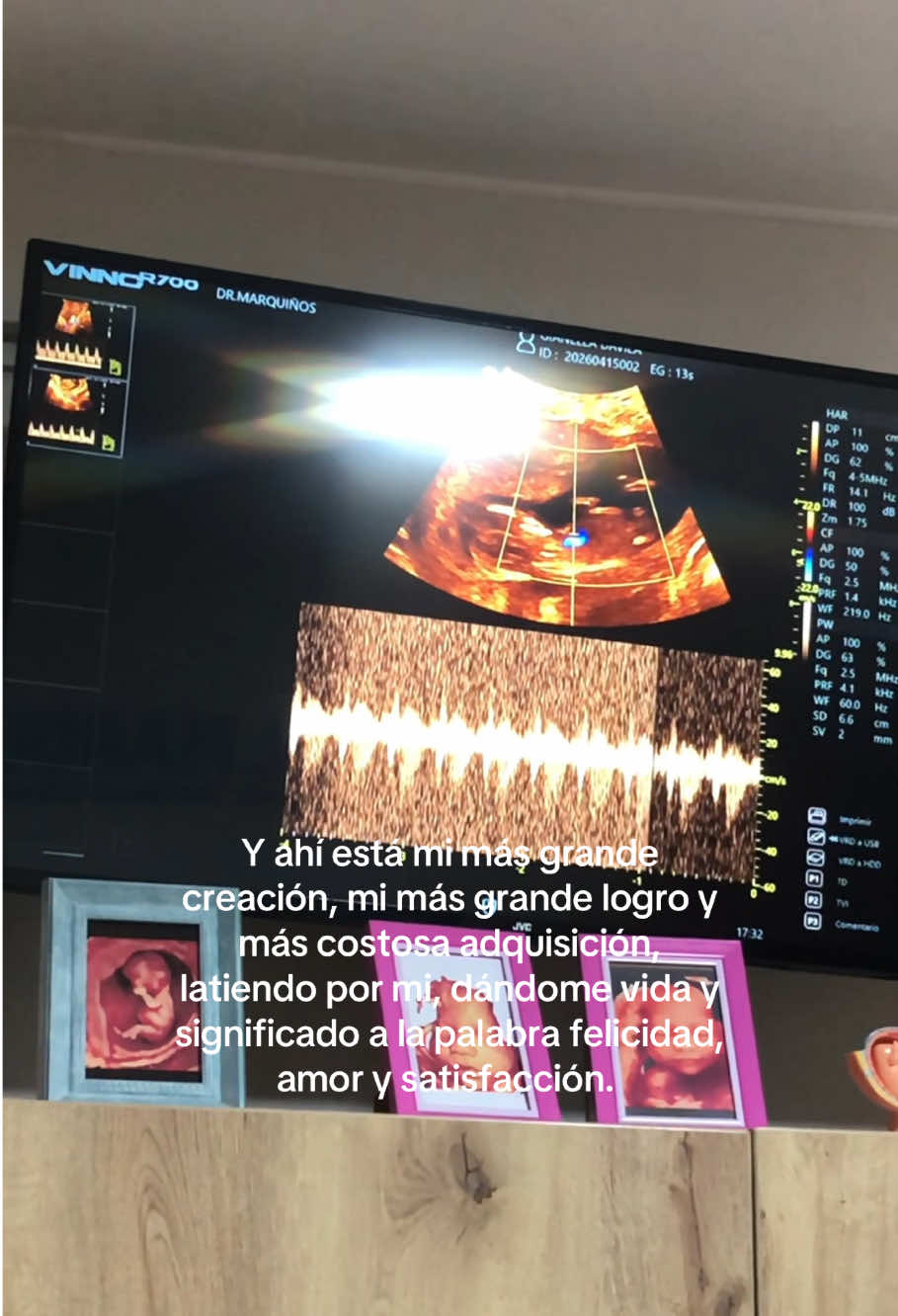 @Gianella 🧸