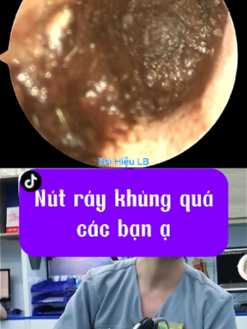 @Bs Hiệu Tai Mũi Họng Long Biên