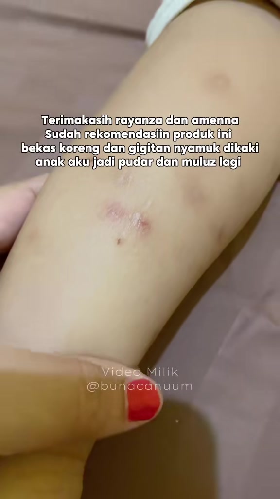 @BunaCanuum