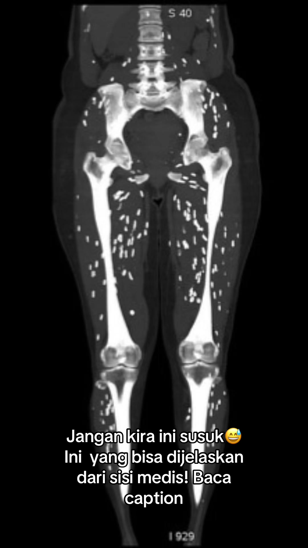 @Sobat Radiology