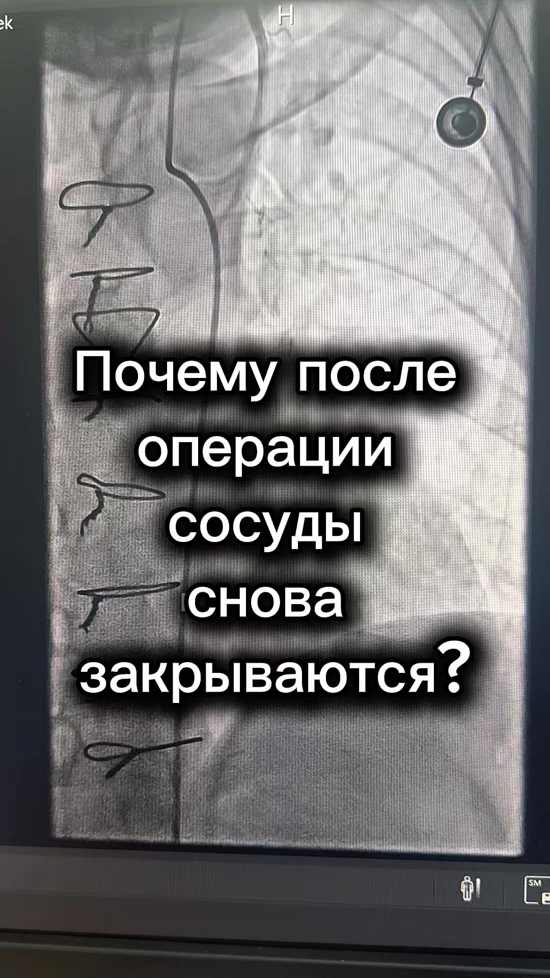 @Кардиолог / Аспет