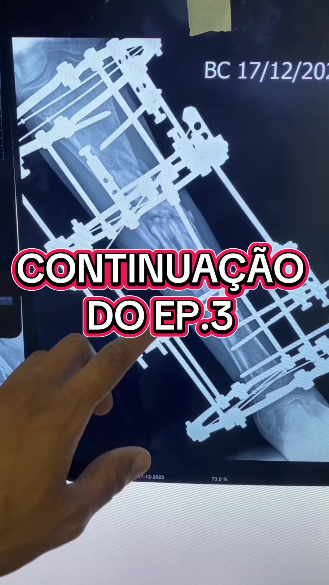 @Halef Henrique