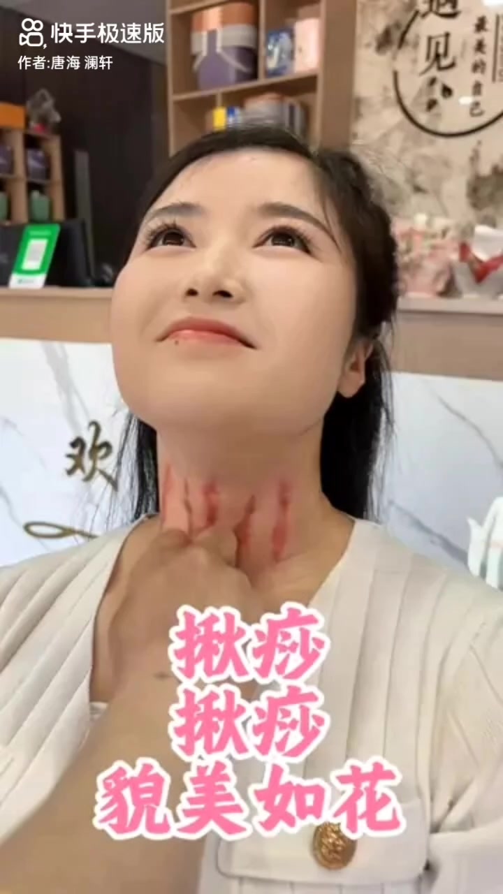 @thích cạo gió