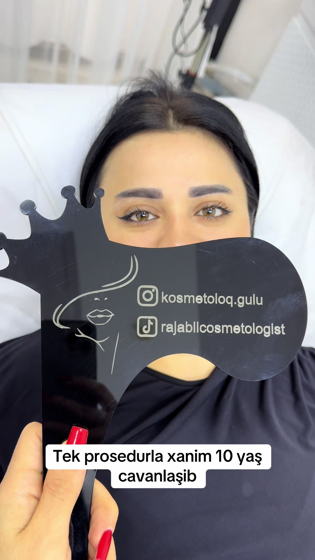 @Kosmetoloq_Gülü_Rajab