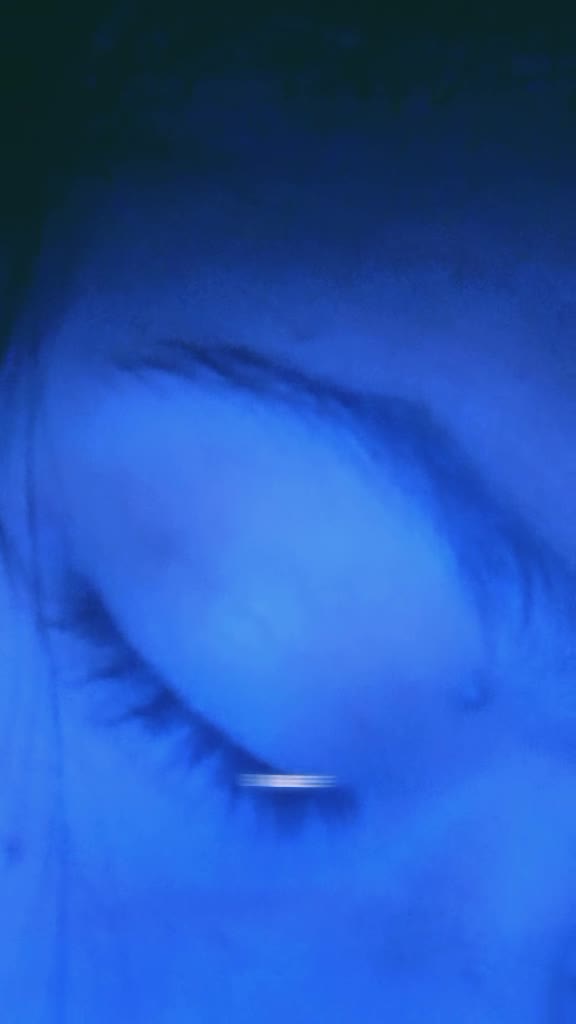 @🙄 NIE NGAW 🙄
