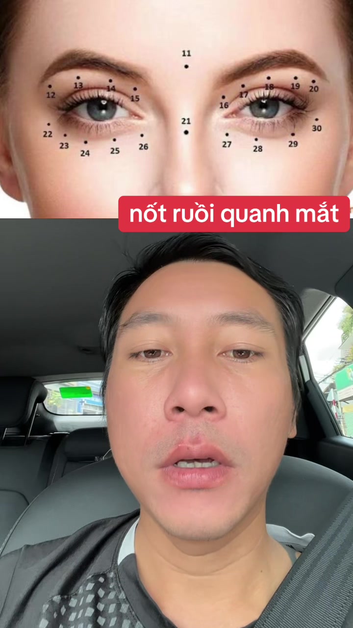 @Tuệ Nhãn ✅