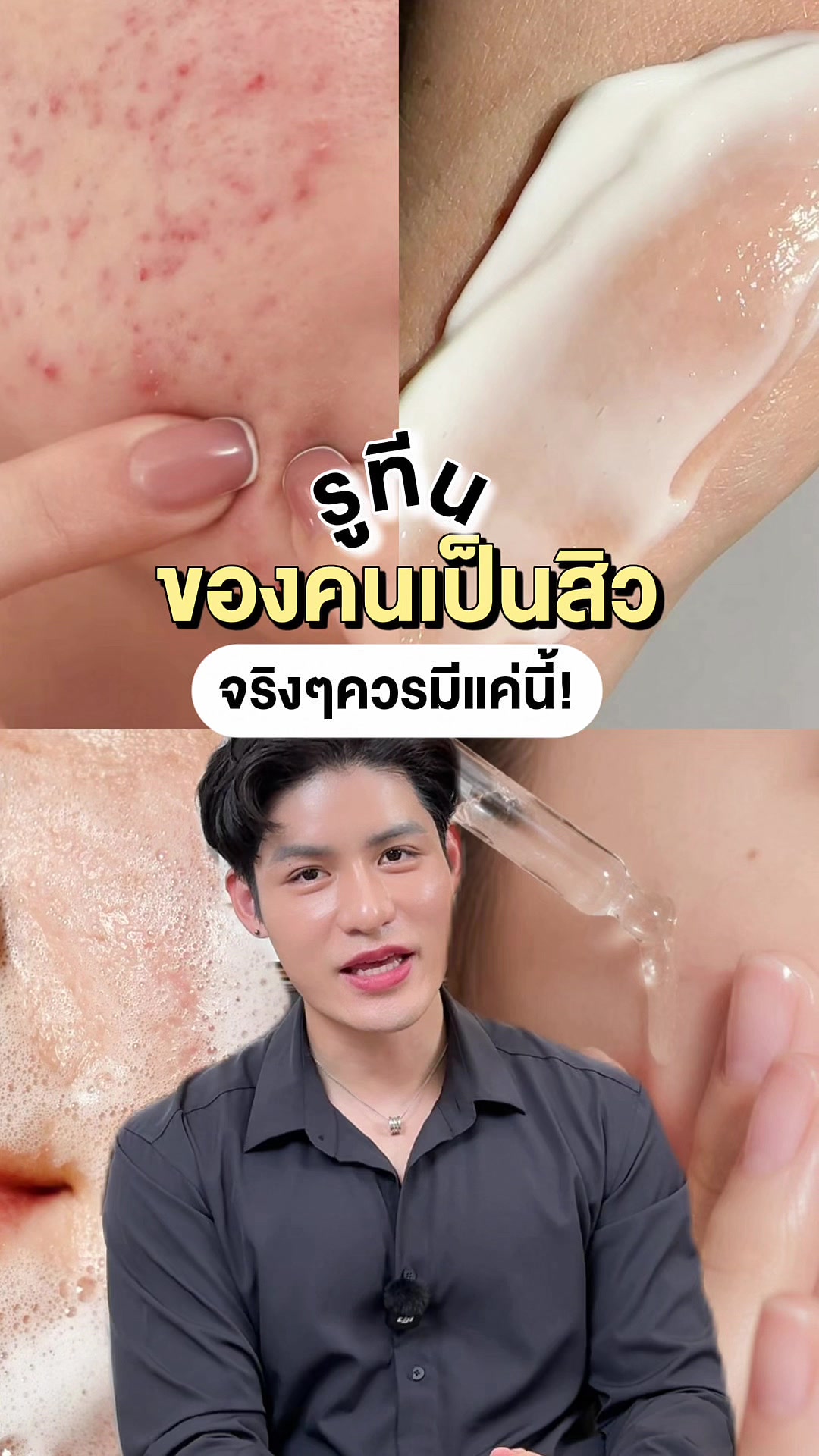 @หนูปอนด์ที่ชอบเลเซ่อร์