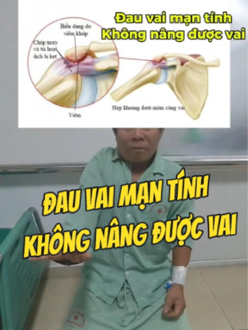 @Chuyên gia xương khớp