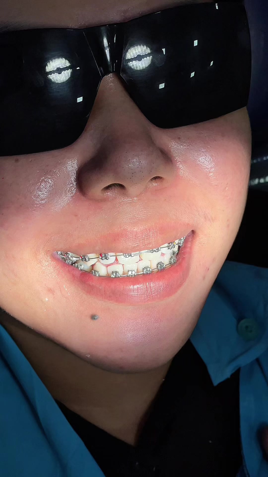 @BRIGHT SMILE DENTAL HOSPITAL