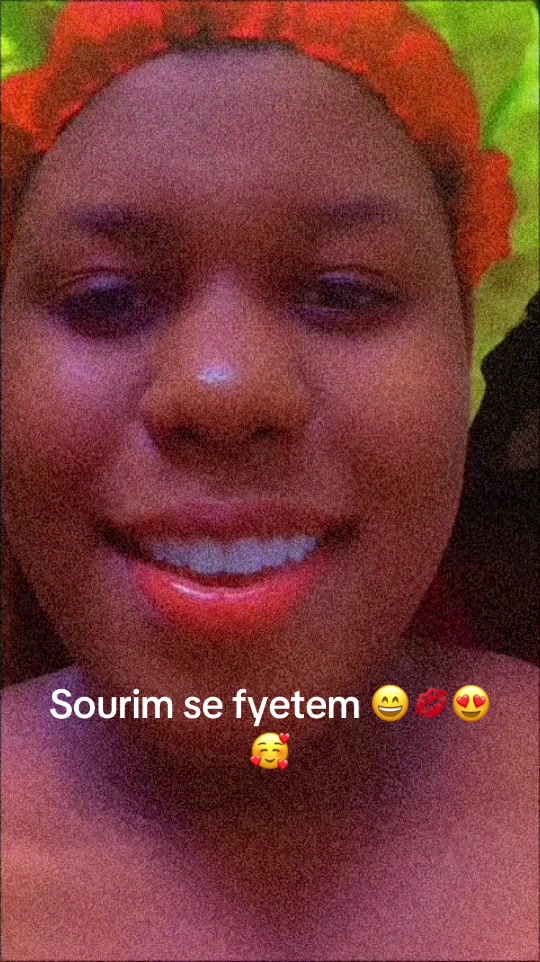 @Bayoo 260