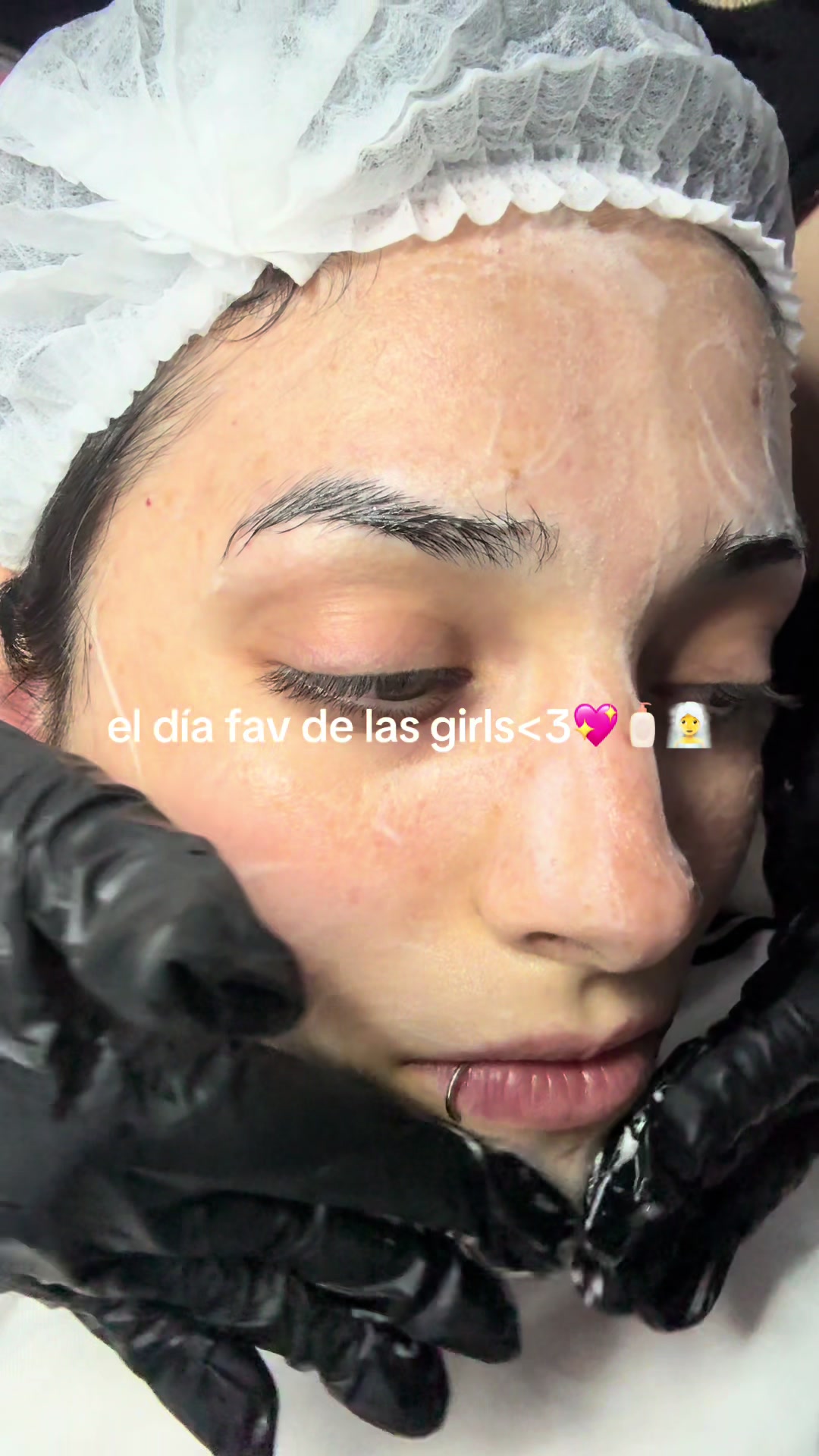 @Orne Baldassarre