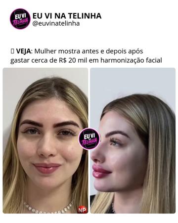 @EU VI NA TELINHA