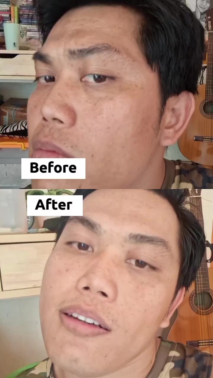 @Leonchandra
