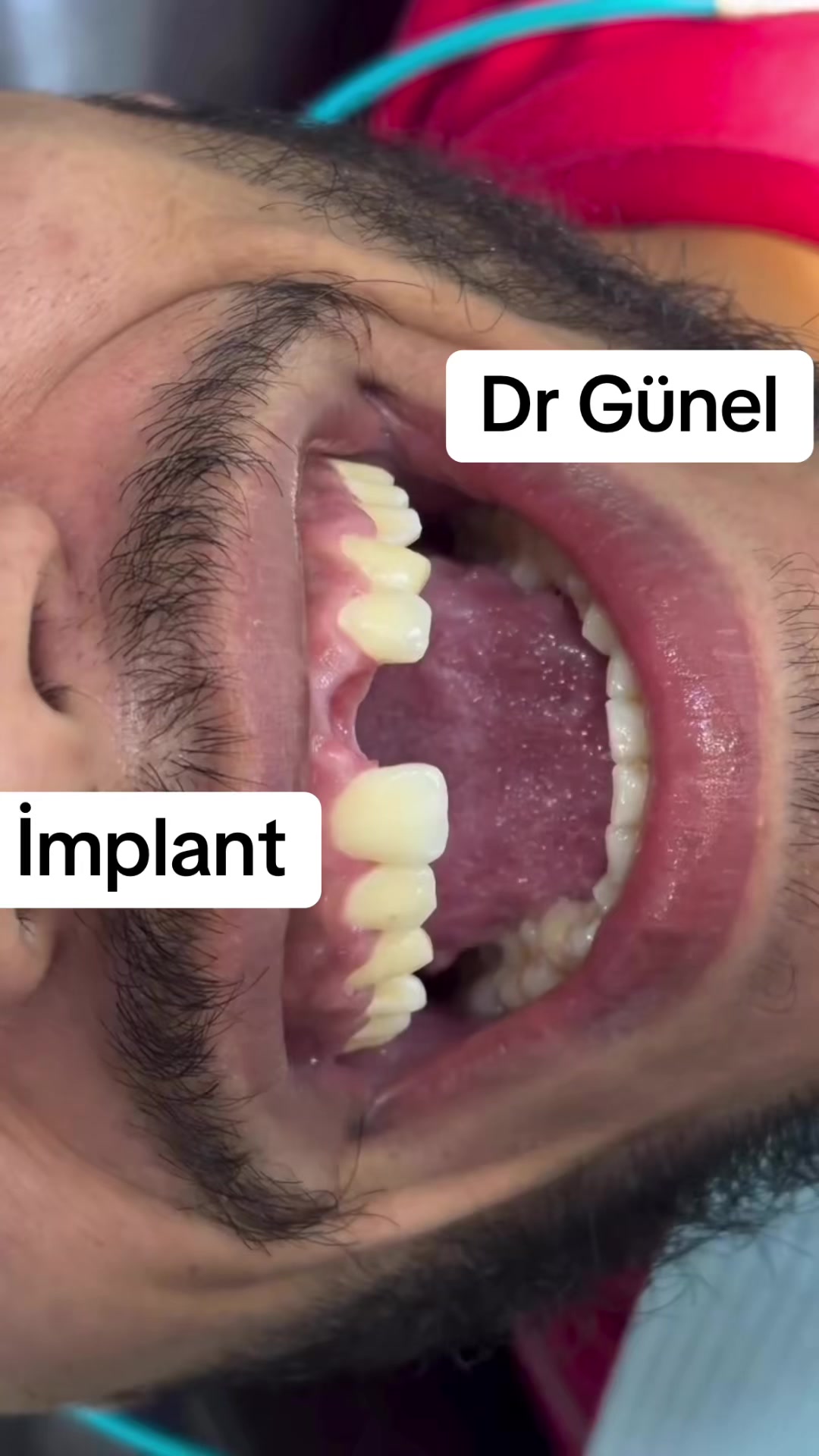 @Dentist_Günel