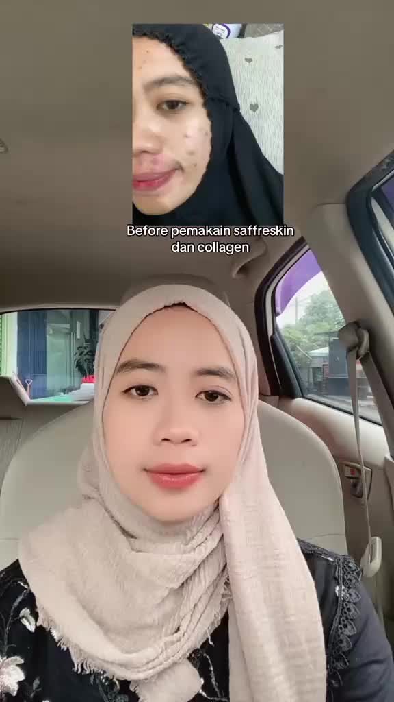 @Topan Pranata