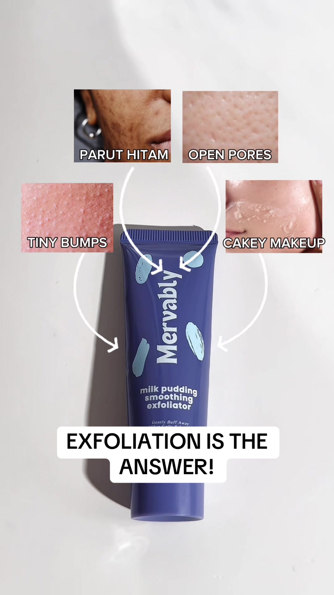 @Mervably Skin