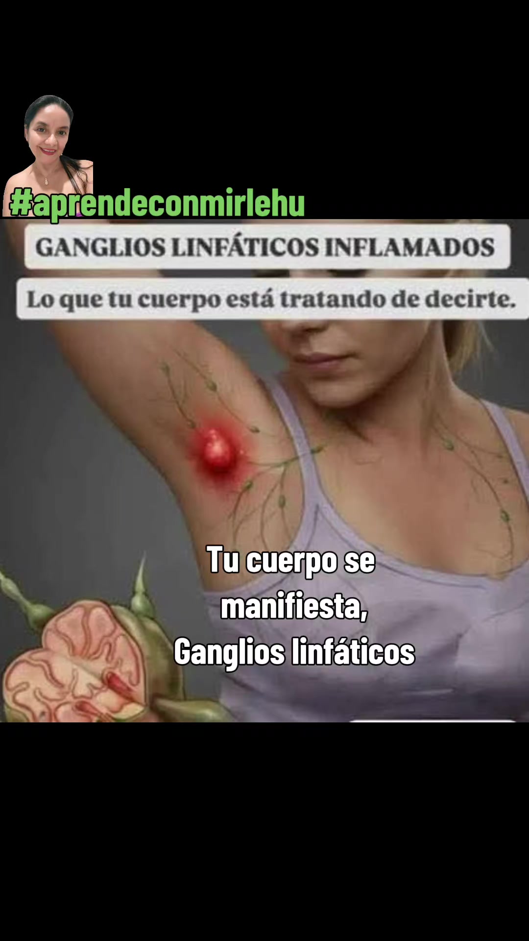 @Mirlehu