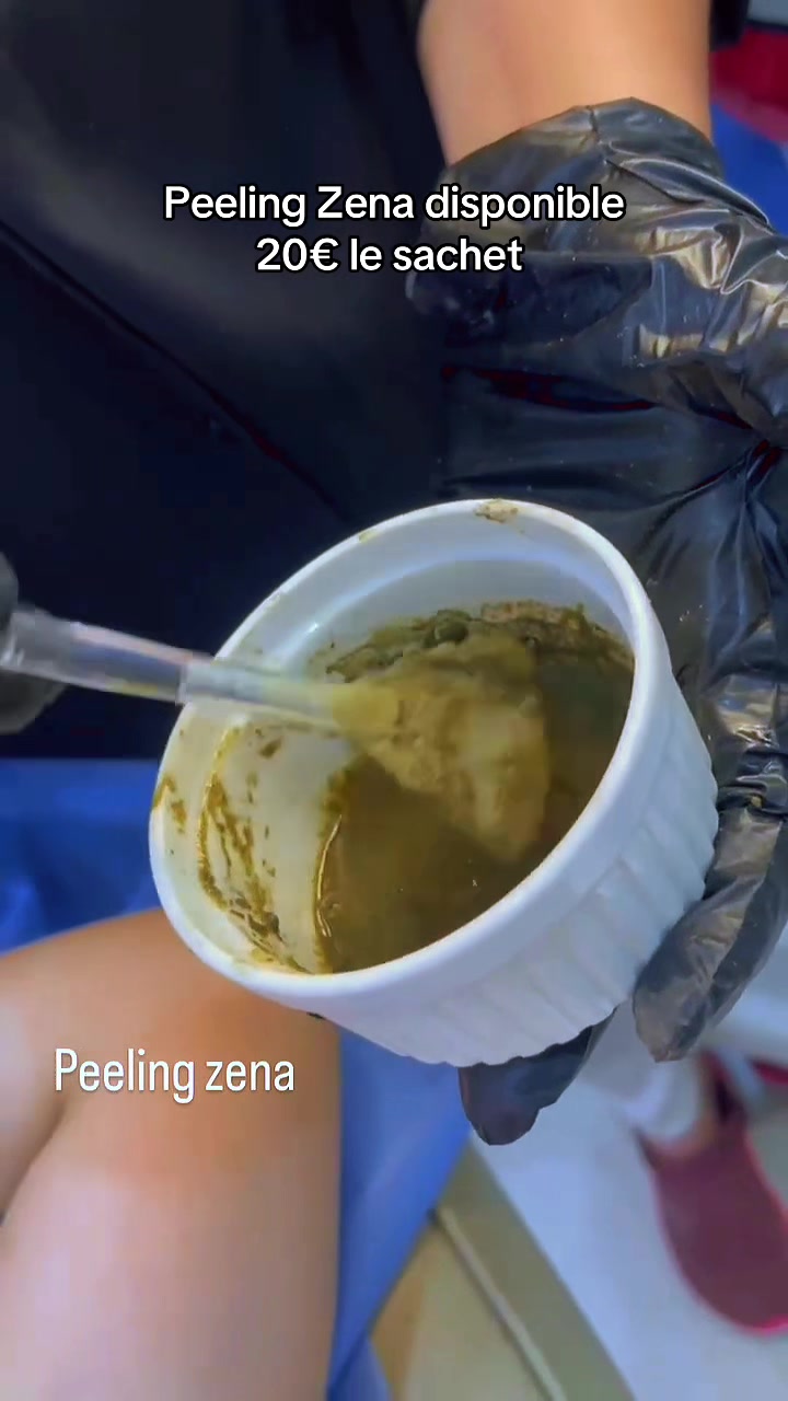 @peeling_zena