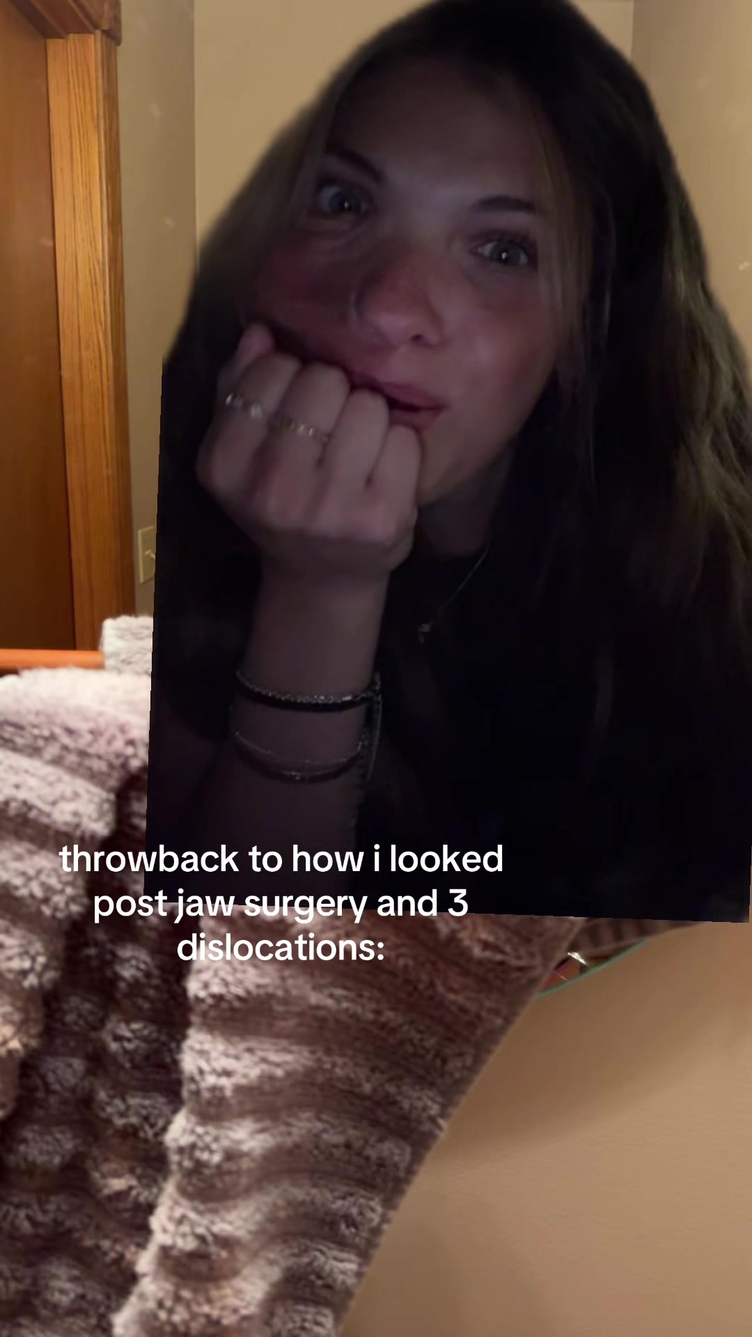 @anna