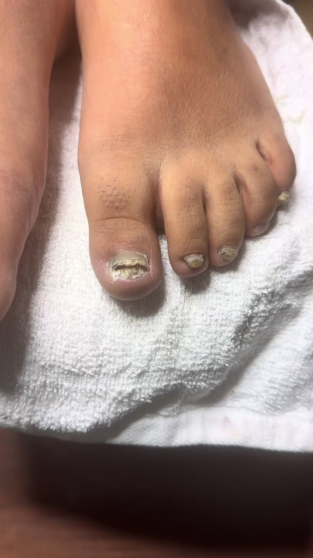 @ToesbyKoki
