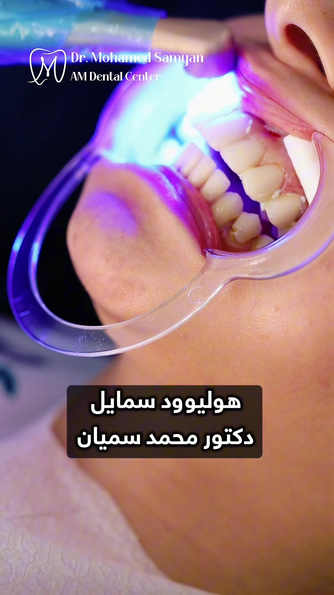 @Dr.Mohamed Samyan