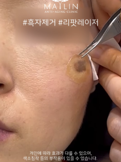 @메이린의원대구점